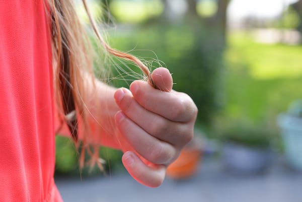 Komplikasi Alopecia Areata - Womanindonesia.co.id